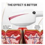 Professional IPL Laser Machine Manufacturer - 480/530/590/640/690nm Hair Removal Acne Treatment DPL Tool