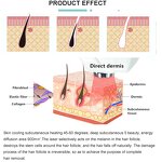 2 in 1 Picolaser ND YAG Machine Manufacturer - 2025 808nm Laser Tattoo Removal Ice Skin Rejuvenation Tool