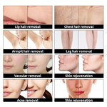 2000w IPL E Light DPL Machine Manufacturer - Sr Elight Whitening Skin Rejuvenation Hair Acne Removal Device