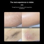 Ice Cool IPL Laser Machine Manufacturer - 2000w Hair Removal Whitening Skin Rejuvenation Battery Commercial Tool