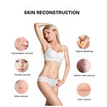 CO2 Fractional Laser Machine Manufacturer - Best Selling Vaginal Rejuvenation Skin Tightening Removal Treatment Tool