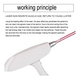 Nd Yag Laser Tattoo Removal Machine Manufacturer - Strong Power 1064/532nm Carbon Peel Laser Beauty Equipment