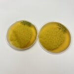 Gel Eye Mask Manufacturer - 2PCS/Set Round Fruit Pattern Cooling for Puffy Eyes