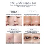 Beauty Care System Manufacturer - Integrated Total Large Bubble PDT Scalp Treatment