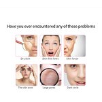 BB Face Beauty Device Manufacturer - 2024 Portable Hot Selling Mesotherapy for Skin Rejuvenation