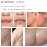 Diode Laser Machine Manufacturer - Professional Desktop 755 808 1064 for Hair Removal