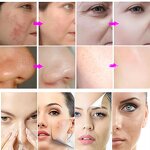 Facial Machine Manufacturer - 3-in-1 Oxygen RF Ultrasonic with LCD Touchscreen UK/US/Italian