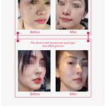 BB Face Beauty Device Manufacturer - 2024 Portable Hot Selling Mesotherapy for Skin Rejuvenation