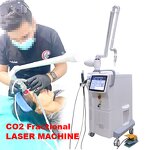 CO2 Laser Beauty Equipment Manufacturer - Fractional for Stretch Mark and Scar Removal