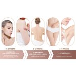 IPL Epilator Manufacturer - Ice Cold Professional for Female with Cooling