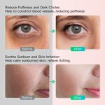 Ice Face Roller Manufacturer - Silicone for Face and Eye Skin Care