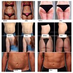 EMS Muscle Stimulator - 15 Tesla 2 Handles Portable Body Sculpting Machine