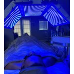 14IN1 Hydro Facial Machine - Multifunctional Hydra Dermabrasion with Oxygen Dome