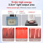 IPL Hair Removal Device Manufacturer - ICE Cooling 999999 Flashes Skin Rejuvenation