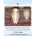 RF Beauty Device Manufacturer - Portable for Facial Skin Rejuvenation & Lifting