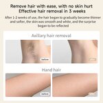 IPL Hair Removal Device Manufacturer - 10-15J Energy Adjustable for Women & Men