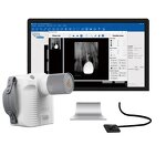 Portable Dental Xray Machine - Factory Wireless 70KV High Frequency CE Certified