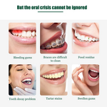 Cordless Water Flosser - Travel Portable Kids Large Tank Jet Dental Irrigator