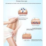 Silicone Scar Sheet - Medical Grade Reusable Waterproof Gel Scar Treatment Strip