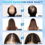 Desktop AI Scalp Analyzer - Mirror Device 5 In 1 Hair Loss Treatment Spa Detector