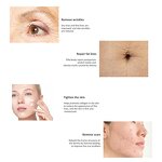 4D Co2 Laser Machine - Skin Resurfacing Scar Acne Tattoo Removal Beauty Device