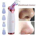 Blackhead Remover Manufacturer - Multifunctional Vacuum Suction for T Zone Pore