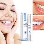Teeth Whitening Pen Manufacturer - Wholesale 2025 Portable for Tobacco Stains 5ml