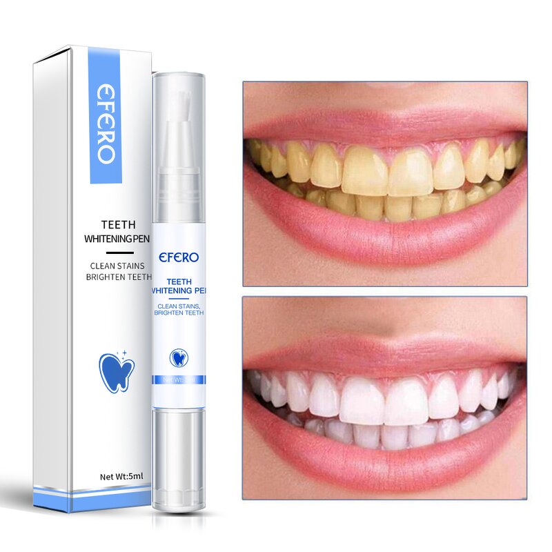 Teeth Whitening Pen Manufacturer - Wholesale 2025 Portable for Tobacco Stains 5ml