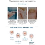 Nail Repair Liquid Manufacturer - Transparent Moisturizing Hand Foot Fungal Treatment