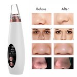 Blackhead Remover Manufacturer - 6 in 1 Electric Vacuum Suction with 6 Suckers