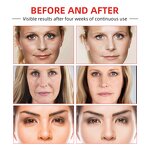 Anti-Wrinkle Cream Manufacturer - West & Month Instant Firming Lifting Fine Lines Repair
