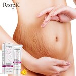 Scars Cream Manufacturer - Mango 40g for Pregnancy Stretch Marks Anti-Aging