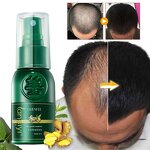 Hair Growth Spray Manufacturer - 7 Days Ginger Anti Hair Loss Fast Grow Serum
