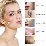 Portable Plasma Pen - Professional Freckles Mole Spot Remove with Led Light