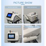 Picosecond Laser Machine - Hot Sales Portable 6 Optional Heads Tattoo Blackhead Removal