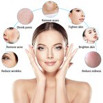 RF Microneedling Machine - 2022 Portable Gold Fraction Needles Skin Tightening