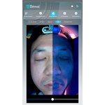 3D Skin Analyzer - 2024 Black Intelligence 5 Lights Scanner Report Device