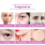 RF LED Eye Massager - Electric Eye Relax Bag Removal Electronic Vision Device