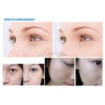 7 in 1 Beauty Machine - Super Sep Promotion Diamond Microdermabrasion Face Lifting