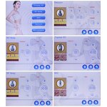 5 in 1 Cavitation Machine - Tuying JF614 Ultrasound Fat Cavitation With BIO