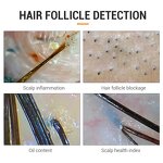 Hair Scalp Analyzer - Hot Sales Desktop Machine for Home and Salon Use