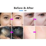 Mesogun Device - Injection Nano EMS RF Needle-free Mesotherapy Pressure Machine