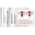 Fractional Laser Machine Manufacturer - Professional CO2 for Stretch Marks & Acne