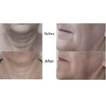 Microcurrent Instrument Manufacturer - AU-8403 Portable 3 in 1 Galvanic BIO Face Lift