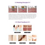 Laser Hair Removal Machine Manufacturer - Standing 808 Diode & ND Yag