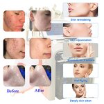 Facial Care Device Manufacturer - H2O2 New 7 in 1 Multifunctional for Skin Care