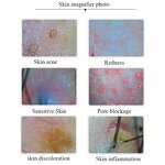 Hair Scanner Manufacturer - High-Precision for Scalp Follicle Health Assessment