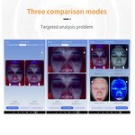 Skin Analyzer Machine Manufacturer - AURO AI Intelligent Digital 36 Million Pixels