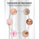 Fractional Laser Machine Manufacturer - Professional CO2 for Stretch Marks & Acne