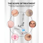 Fractional Laser Machine Manufacturer - Professional CO2 for Stretch Marks & Acne